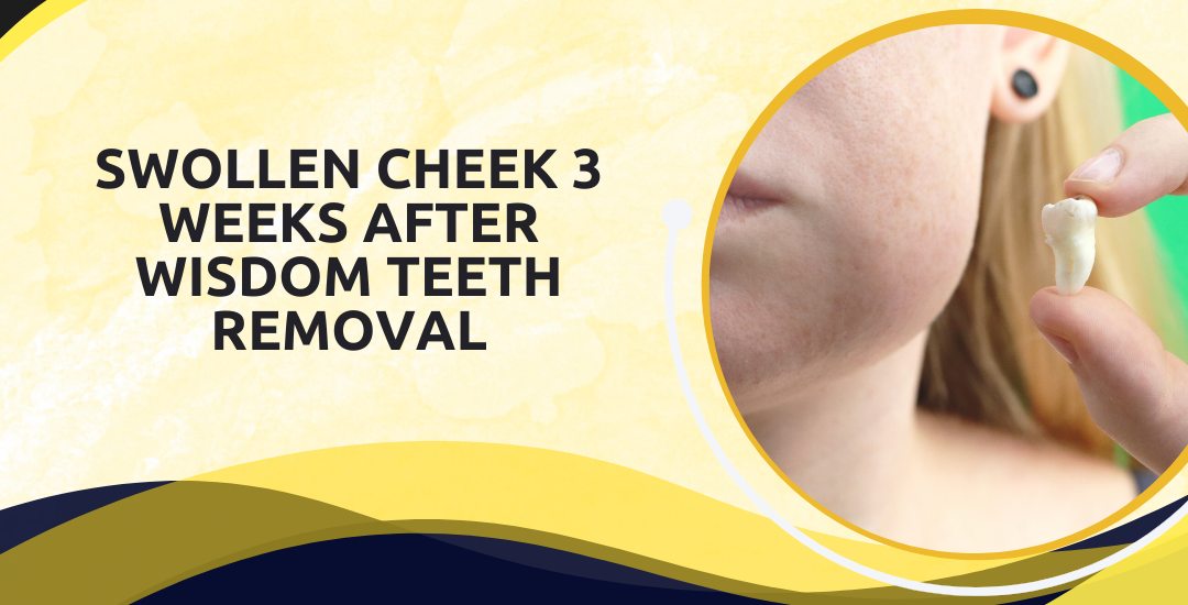 Swollen Cheek 3 Weeks After Wisdom Teeth Removal: When to Worry