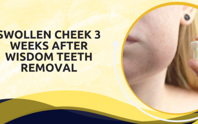 Swollen Cheek 3 Weeks After Wisdom Teeth Removal: When to Worry