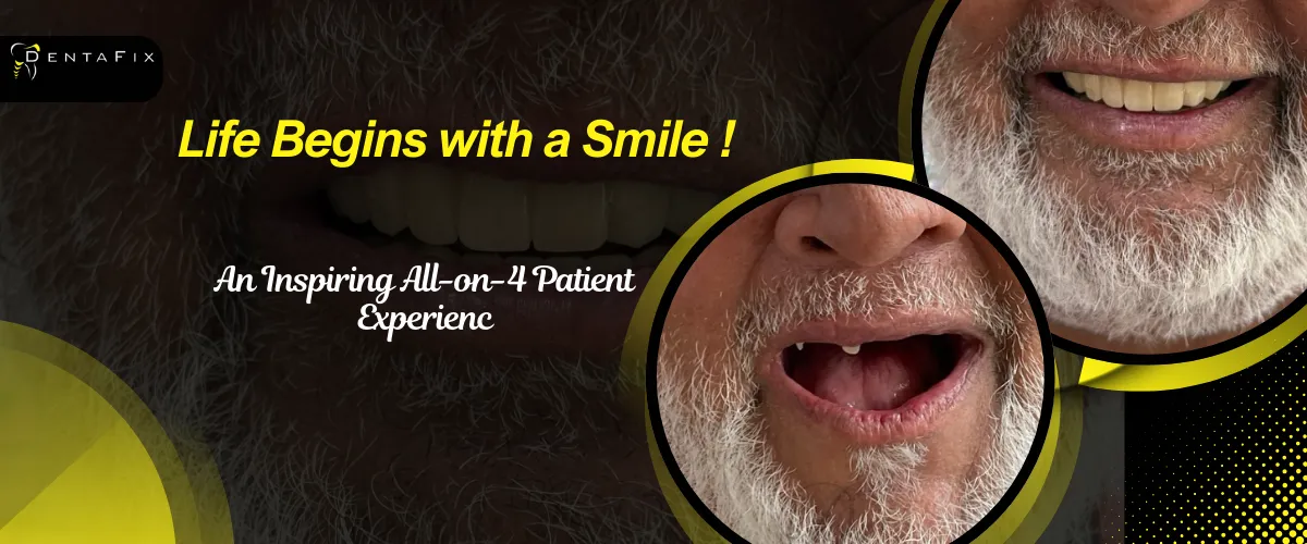 All-on-4 Dental Implants Procedure