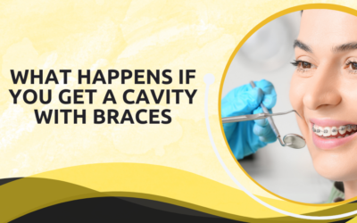 What Happens If You Get a Cavity with Braces?