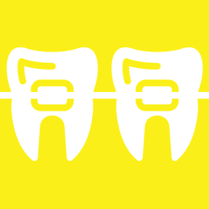 Braces Aligner | Dentafix Dental Clinic